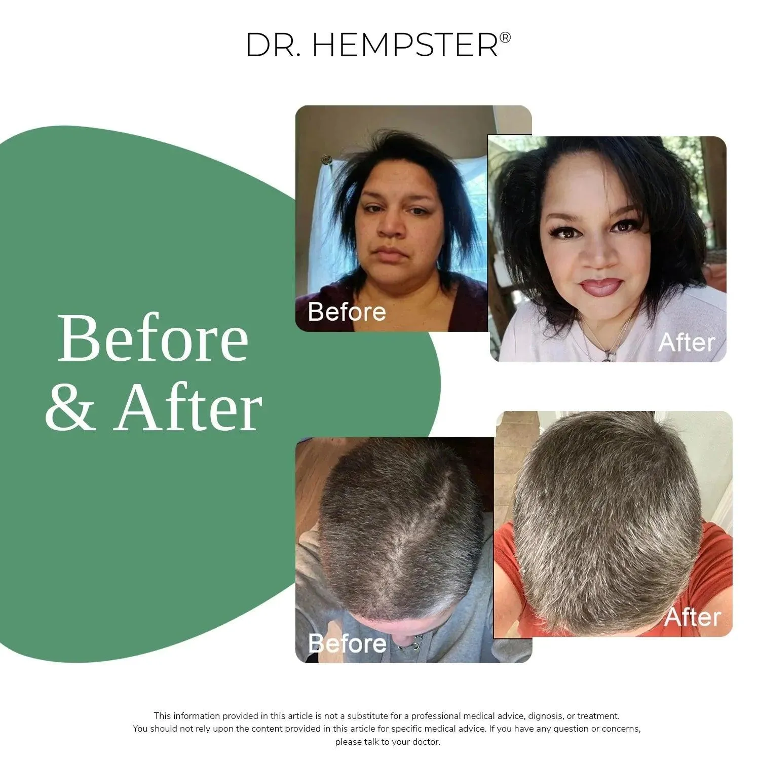 Dr. Hempster Shampoo & Conditioner Bundle